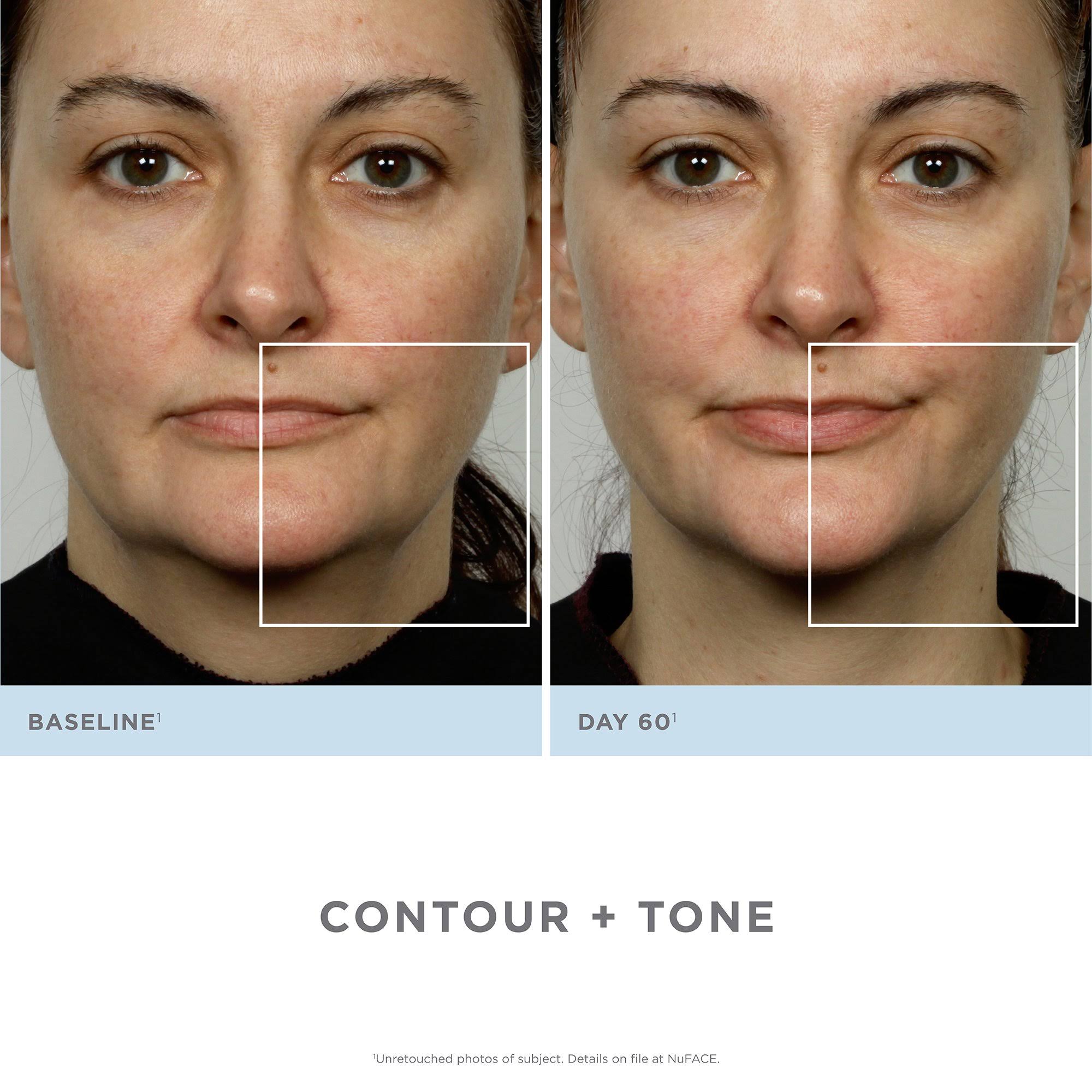 Facial Toning Kit B356316