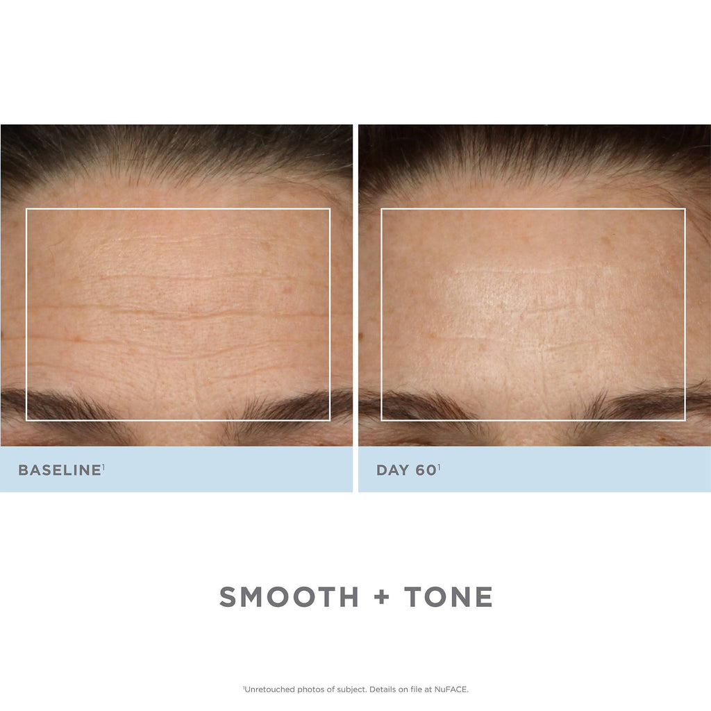 Facial Toning Kit B356316