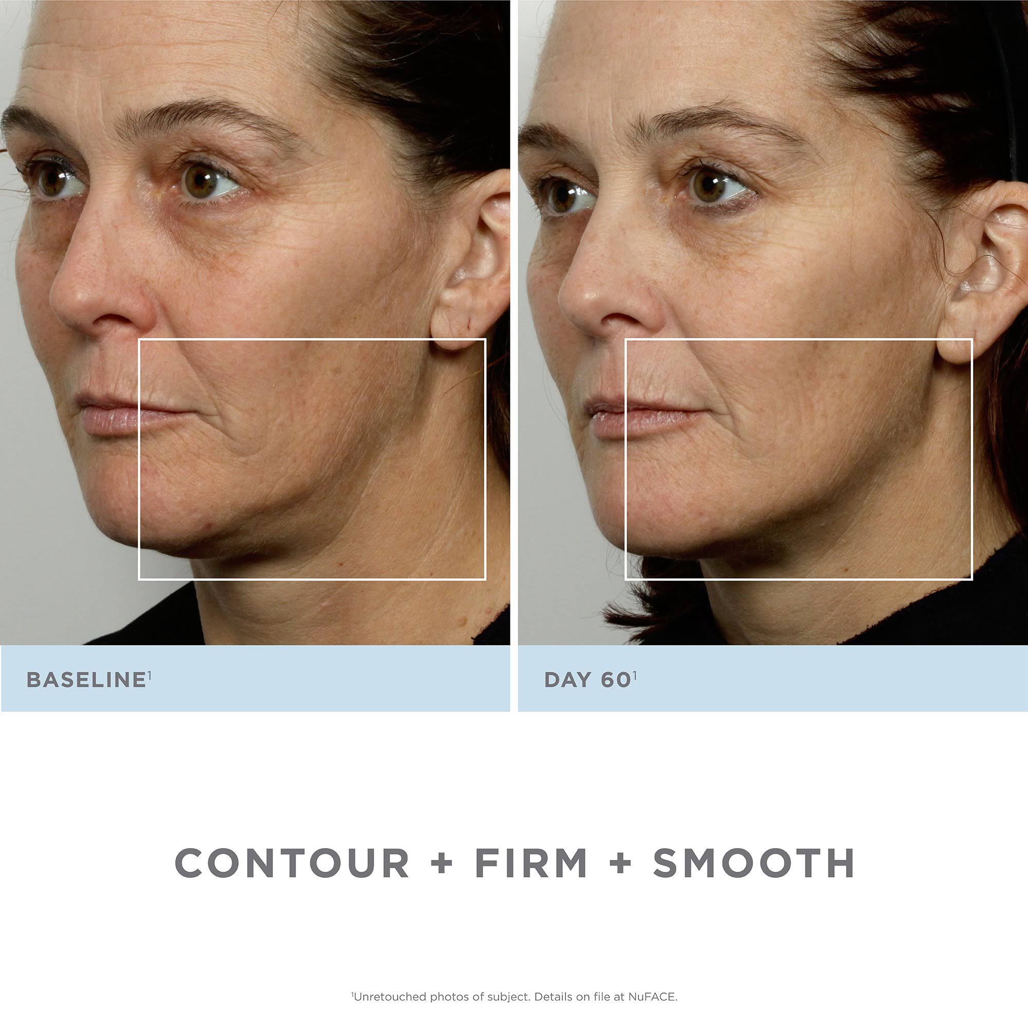Facial Toning Kit B356316