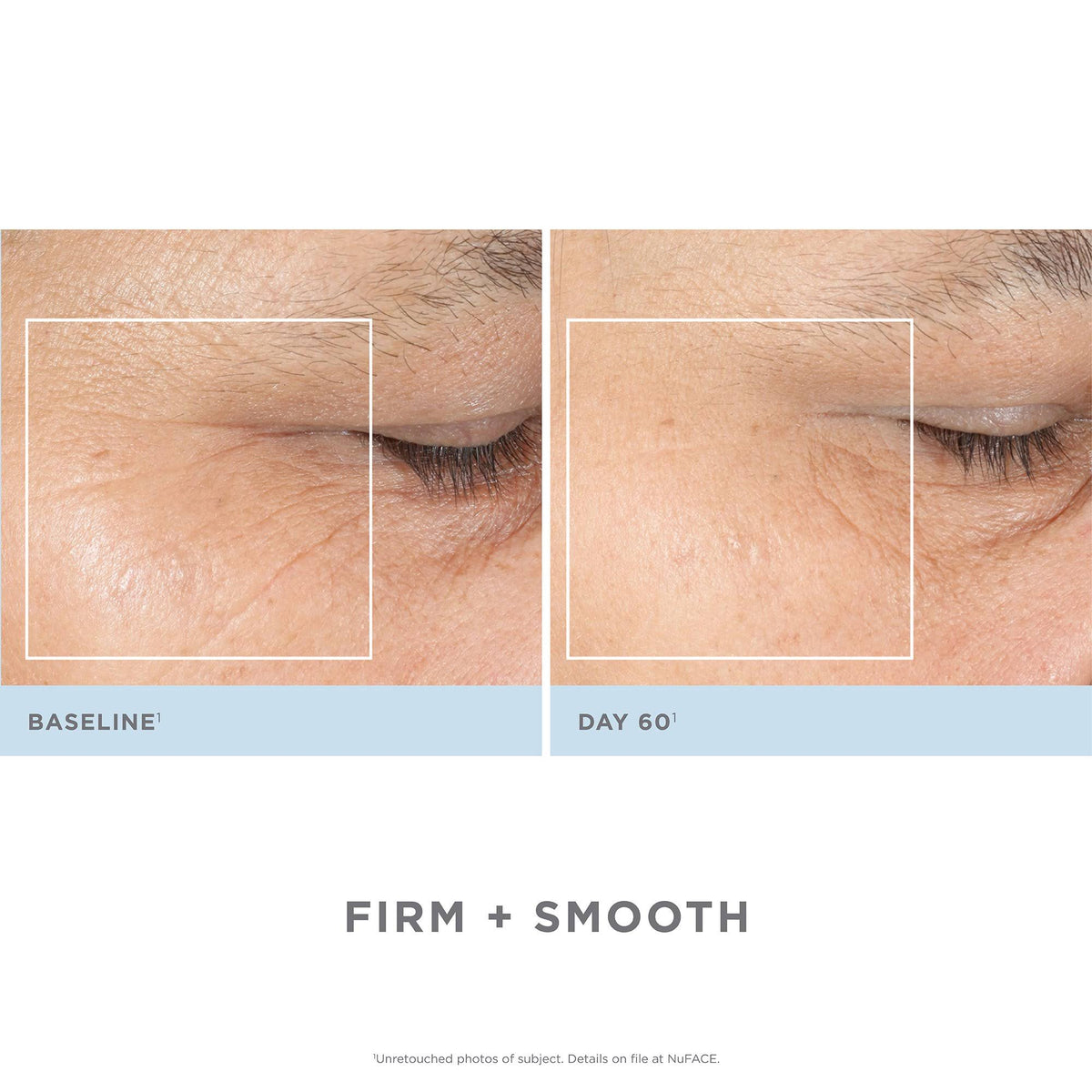 Facial Toning Kit B356316